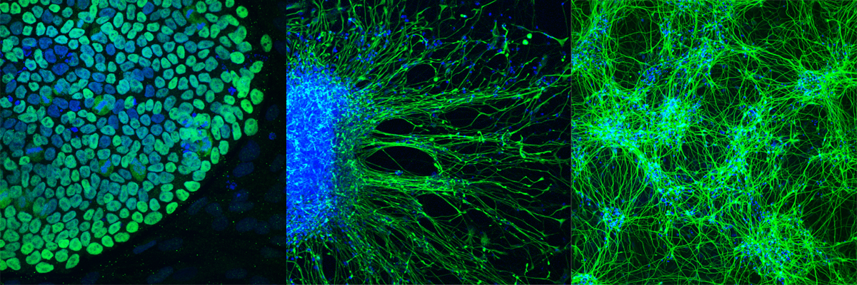 Human Embryonic and Induced Pluripotent Stem Cell Unit