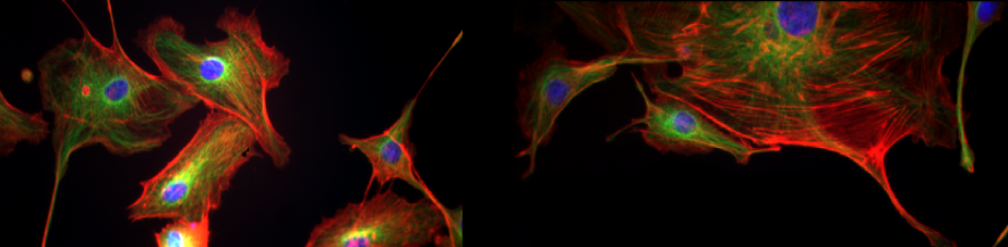 lab mor neurobiol anosol